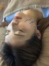 ネレール鍼灸マッサージ治療院/