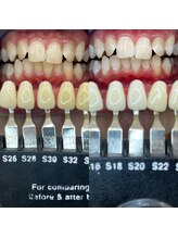 トウキョウスワーズ 池袋店(TOKYO SWRS)/#ホワイトニング #池袋 #渋谷
