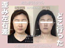 ジェイミー(Gemiey)/歪み、左右差整ってきました！！