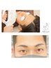 【お得セット】お顔脱毛×ハリウッドブロウリフト　￥13900→￥11500