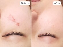 至空院/レストセルトリートメント