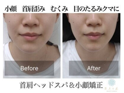 美人ヶ丘の写真