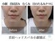 美人ヶ丘の写真