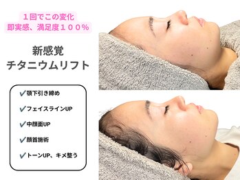 看護師監修サロン cocofleur 三軒茶屋【チタニウム/ピーリング/毛穴/小顔】の写真/【最先端機器で即効たるみケア】3つの光波長を同時照射!アレイズライトで中顔面UP&首~顎下肉もスッキリ♪