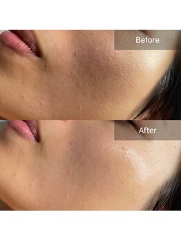 ハートランド(HEARTLAND)/たった1回でここまで変われる