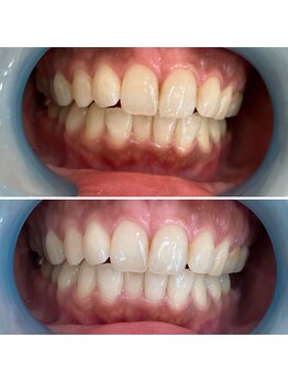 シャイニー 仙台駅東口(SHINY)/お客様の変化