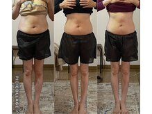 しあわせ腸研究所/腸もみbefore & after