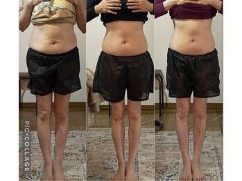 しあわせ腸研究所/腸もみbefore & after