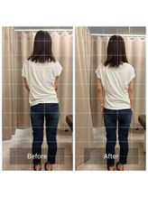 みらい整骨院/腰痛が原因での背骨の歪みも改善