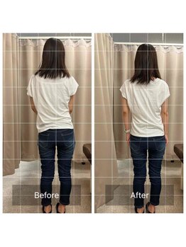 みらい整骨院/腰痛が原因での背骨の歪みも改善