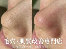 #美容革命ラボ 大阪南堀江店