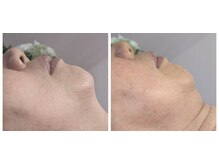 シードリーフ ホームスパの雰囲気（秋のうるつやしっとりfacialでトーンアップ）