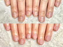 グレースレディ 大阪店/深爪/自爪育成/フィルイン