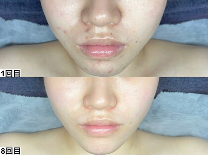 アンドミー 高崎店(&me)の写真