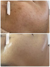 サロンニーナ(Salon.Nina)/韓国肌管理セルマン