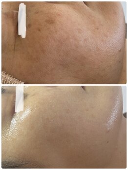 サロンニーナ(Salon.Nina)/韓国肌管理セルマン