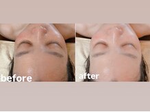 ベルガーデンスパ(BELLE garden spa)の雰囲気(人気のフェイシャルWAXで毛穴・シミケア、エイジングケアを♪)