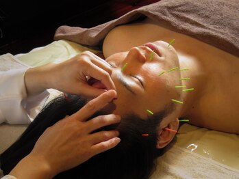 アディクト(Addict)の写真/エステサロンの美容鍼専門店!!ハンドテクニック×鍼で老廃物排出を促しスッキリ実感♪お得なクーポン多数★