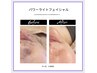 【肌トラブルケア】理想の美肌へ♪　パワーライトフェイシャル¥9900→¥6000