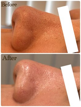 グラサヴォーグ 金沢店/パーソナルフェイシャルすごい♪