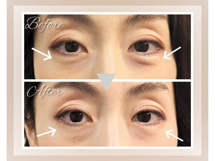キラリ(Kirari)の写真