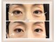 キラリ(Kirari)の写真