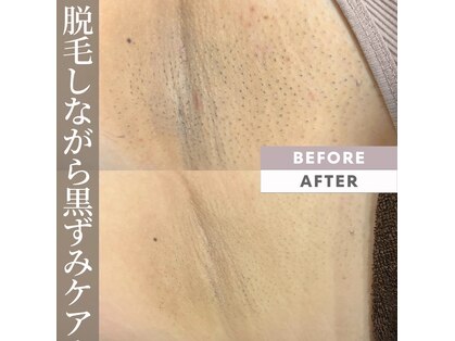 モアトゥインクル 岡山店(MORE twinkle)の写真