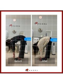 ナオル整体 北千住院(NAORU整体)/前屈可動域改善