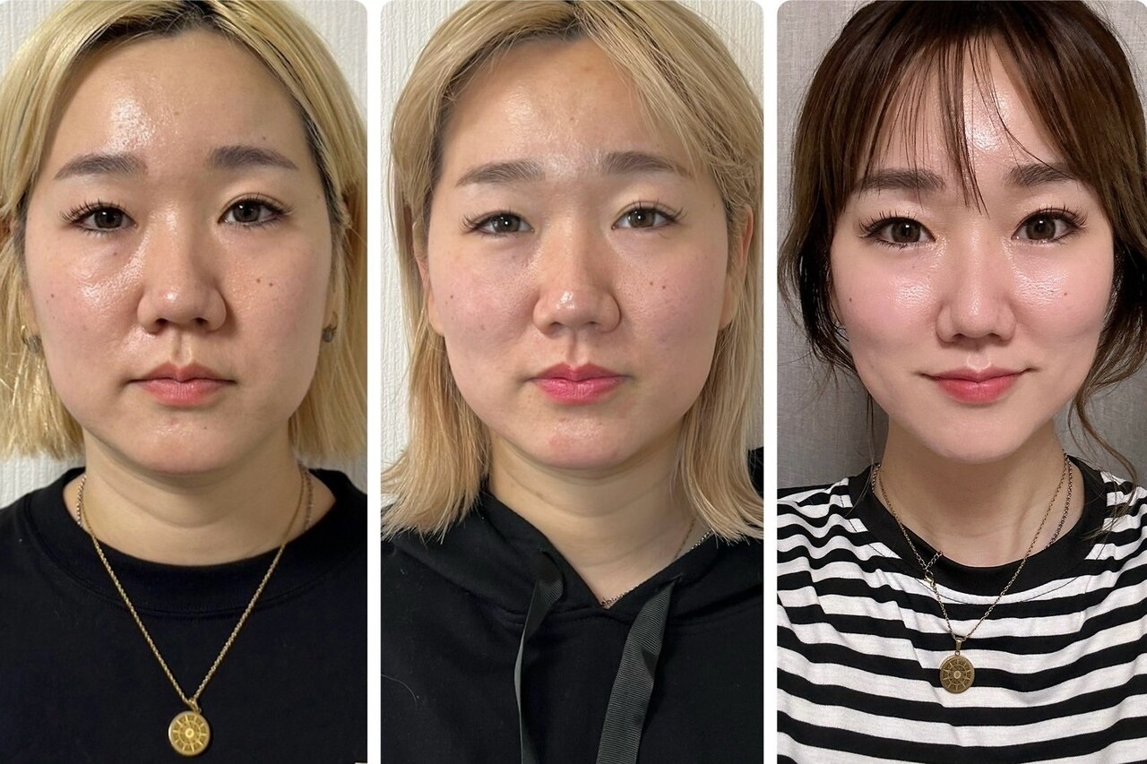 【エステサロンプロでも、ホームサロンとしても！お顔のたるみに】リンパボーラー エステサロンプロでも、ホームサロンとしても！お顔のたるみに