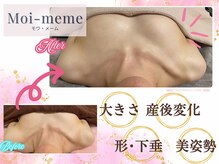 モワメーム(Moi-meme)