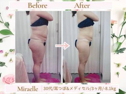 ミラエル(Miraelle)の写真