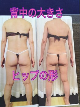 ボディエステティック アクアオーラ 富山店/背中の大きさ、ヒップの形