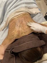 カシェットトーキョー(Cachette Tokyo)/背中2Bバイオ5g/美しい背中へ！