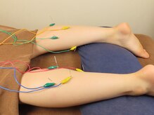 ビファイン鍼灸治療院 代々木上原院/はり施術　ふくらはぎ　パルス