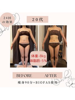 ビープロデュース 尾張旭店(B' PRODUCE)/20代 90分メニュー 24回