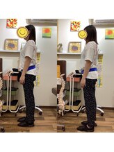 ヒデ整体院(Hide整体院)/腰痛　反り腰改善　姿勢骨盤矯正