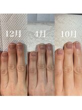 スティラ(Stila)/自爪育成/深爪育成/自爪風仕上げ