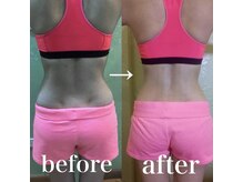 スパチャーレ(Spa ciare)/【トーンヌール】before＆after