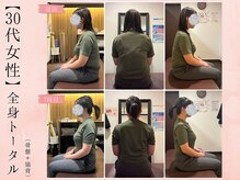 サクラ(SAKURA)/【30代】Before After