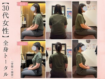 サクラ(SAKURA)/【30代】Before After