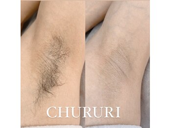 チュルリ 新町店(Chururi)/脇ワックス脱毛