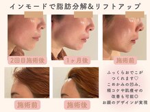 ミーカラー(mecalla.)