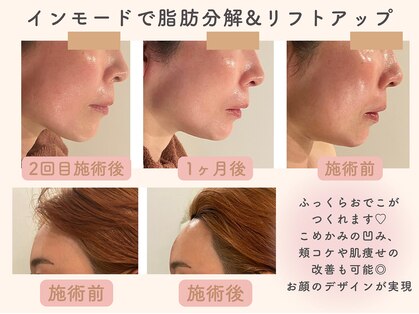 ミーカラー(mecalla.)の写真