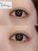 ラディーチェ アイラッシュ(Radice eyelash)