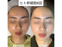 ヴィヴ 三島店(Vive)/《ヒト幹細胞》