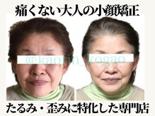 顔凛(カオリン)