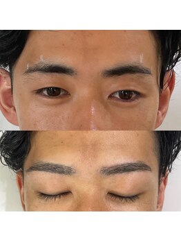 ビオプラス(BIO PLUS)/