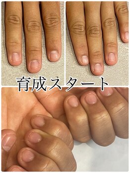 グレースレディ 神戸北店/