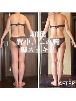 アーユルヴェーダアンドアロマエステ アユス(AYUS)/【40代】初回⇒5回目