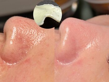 ルーナジェーナ(Luna llena)/池袋 エステ ルーナジェーナ